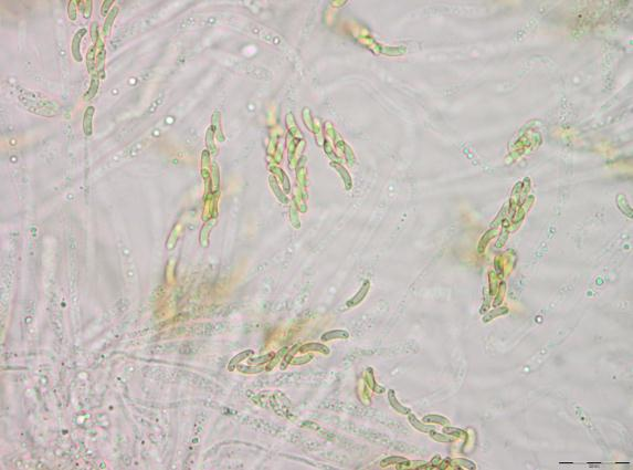 Ekte sekksporesopper: Eutypella cerviculata.