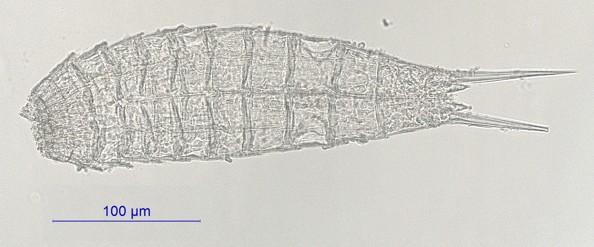 Cephalorhyncher: Echinoderes setiger.