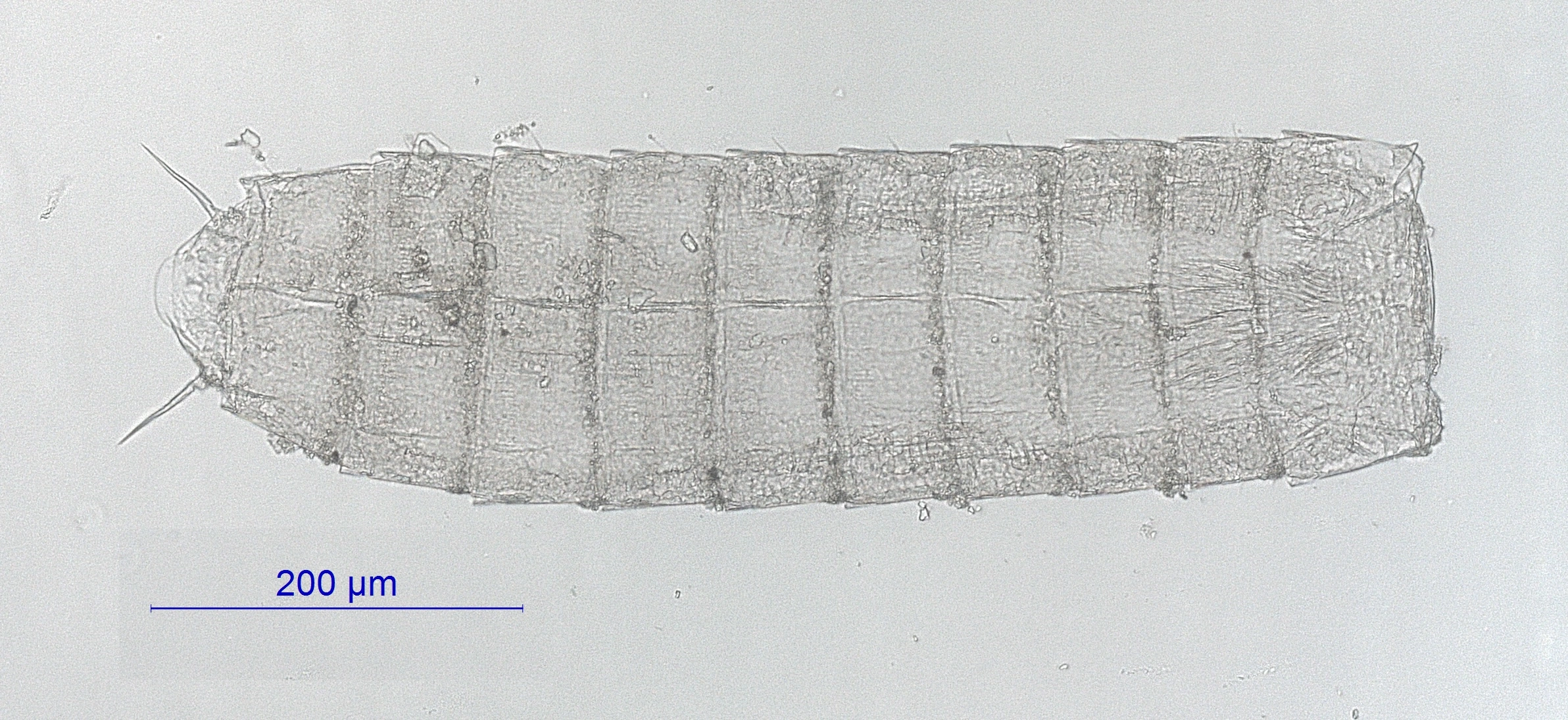 Cephalorhyncher: Pycnophyes kielensis.