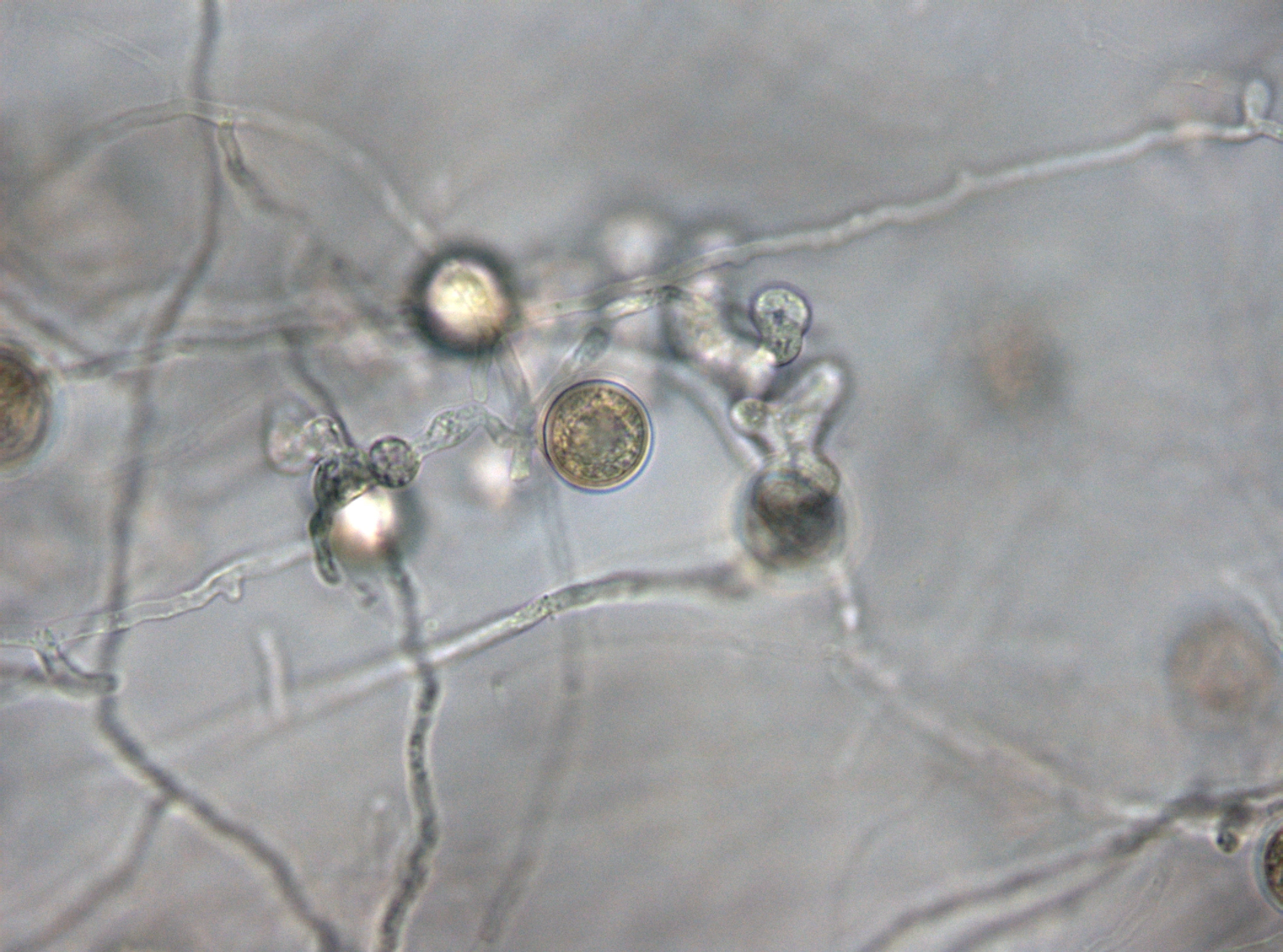 Eggsporesopper: Pythium torulosum.